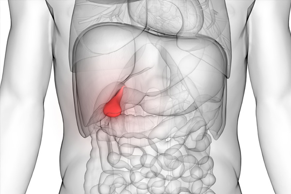 Gallbladder Diseases